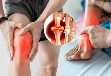 Schéma d'application du gel Icexin sur la zone de l'articulation du genou et du pied